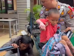 Peduli Dengan Sesama, Kasat Lantas Polres Nias Bantu Anak Pemulung Korban Luka Bakar