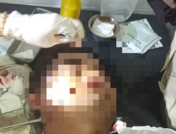 Pertunjukan Singo Wulung di Pemandian Tasnan Bondowoso Memakan Korban, Penyelenggara Belum Beri Tanggapan