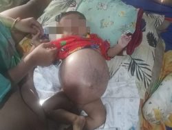 Kondisi Terkini Bayi Enam Bulan Asal Batealit Terkena Kanker