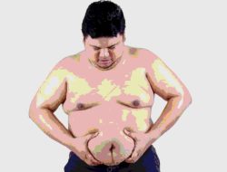 Cara Cepat Mengurangi Lemak Perut: Rahasia Tubuh Ideal
