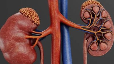 Bahan Alami Pembersih Ginjal yang Terbukti Ampuh