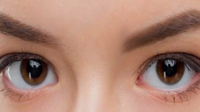 Cara Menghilangkan Kerutan di Kelopak Mata Secara Alami dan Efektif